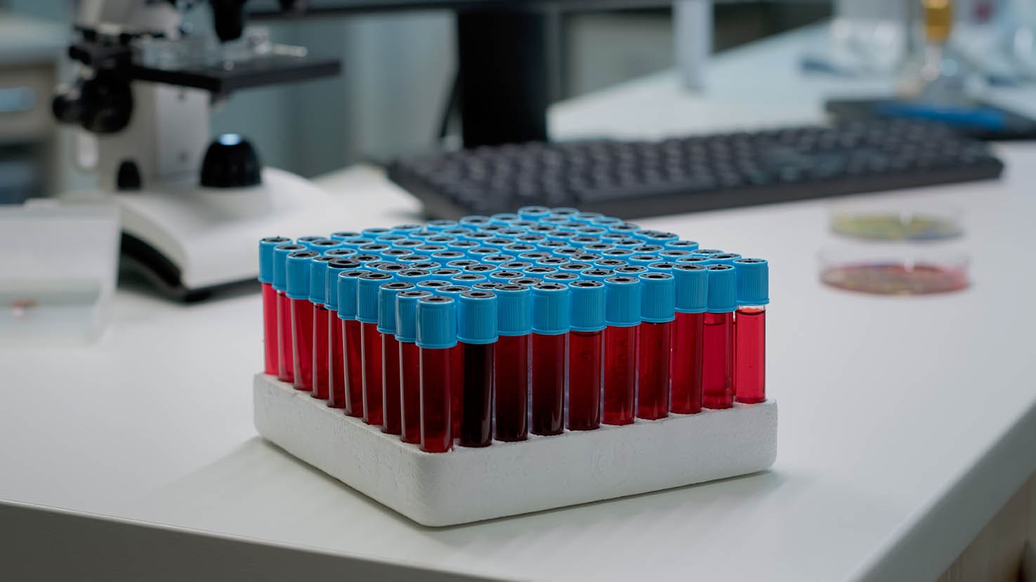 close-up-vacutainers-with-liquid-blood-laboratory-desk-tray-research-test-bottles-fluid-dna-preparing-science-analysis-equipment-pharmaceutical-development-industry